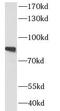 Msk antibody, FNab07866, FineTest, Western Blot image 