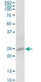 NOP16 Nucleolar Protein antibody, H00051491-B01P, Novus Biologicals, Western Blot image 