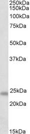 GM2 Ganglioside Activator antibody, EB10418, Everest Biotech, Western Blot image 