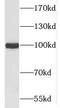 Cluster of Differentiation 10 antibody, FNab05229, FineTest, Western Blot image 