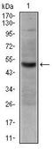 TNF Receptor Superfamily Member 8 antibody, MA5-17044, Invitrogen Antibodies, Western Blot image 