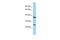 Chromosome 7 Open Reading Frame 61 antibody, A19065, Boster Biological Technology, Western Blot image 