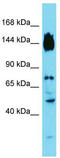 Synapse Defective Rho GTPase Homolog 2 antibody, TA333620, Origene, Western Blot image 