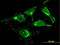 Golgi Membrane Protein 1 antibody, LS-B6228, Lifespan Biosciences, Immunofluorescence image 
