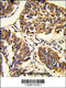 Poly(A) Binding Protein Cytoplasmic 1 antibody, 61-598, ProSci, Immunohistochemistry paraffin image 
