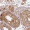 G1 To S Phase Transition 1 antibody, HPA052488, Atlas Antibodies, Immunohistochemistry paraffin image 