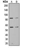 Phosphoinositide-3-Kinase Regulatory Subunit 1 antibody, LS-C358831, Lifespan Biosciences, Western Blot image 