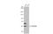 Aldehyde Dehydrogenase 1 Family Member B1 antibody, GTX107279, GeneTex, Western Blot image 