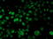 Histidyl-TRNA Synthetase 2, Mitochondrial antibody, M07330-1, Boster Biological Technology, Immunofluorescence image 