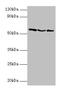 Ubiquitin Specific Peptidase 14 antibody, CSB-PA025704LA01HU, Cusabio, Western Blot image 