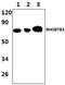 Rho Related BTB Domain Containing 3 antibody, GTX35184, GeneTex, Western Blot image 