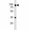 CD19 antibody, F44318-0.4ML, NSJ Bioreagents, Western Blot image 