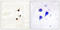 Neurotrophic Receptor Tyrosine Kinase 2 antibody, LS-C199686, Lifespan Biosciences, Immunohistochemistry paraffin image 