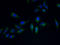 PVR Related Immunoglobulin Domain Containing antibody, A65226-100, Epigentek, Immunofluorescence image 