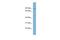 HECT Domain E3 Ubiquitin Protein Ligase 2 antibody, A13817, Boster Biological Technology, Western Blot image 