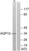 Aquaporin-12A antibody, LS-C119738, Lifespan Biosciences, Western Blot image 