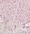 Fibroblast Growth Factor Receptor 4 antibody, orb10658, Biorbyt, Immunohistochemistry paraffin image 