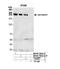 Polybromo 1 antibody, NB100-79832, Novus Biologicals, Western Blot image 