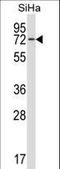 Heat Shock Protein Family A (Hsp70) Member 12B antibody, LS-C203671, Lifespan Biosciences, Western Blot image 