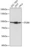 Integrin Subunit Beta 8 antibody, A06744, Boster Biological Technology, Western Blot image 