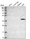 Cyclin Dependent Kinase 8 antibody, PA5-65388, Invitrogen Antibodies, Western Blot image 