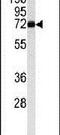 Monoamine Oxidase B antibody, PA5-14409, Invitrogen Antibodies, Western Blot image 