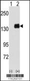 Pumilio RNA Binding Family Member 1 antibody, 62-999, ProSci, Western Blot image 