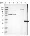 HLA class II histocompatibility antigen, DQ beta 1 chain antibody, NBP1-84549, Novus Biologicals, Western Blot image 