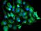 Tubulin Alpha Like 3 antibody, MA5-25780, Invitrogen Antibodies, Immunocytochemistry image 
