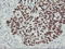 p53 antibody, LS-C796680, Lifespan Biosciences, Immunohistochemistry paraffin image 