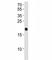 HRas Proto-Oncogene, GTPase antibody, F50750-0.4ML, NSJ Bioreagents, Western Blot image 