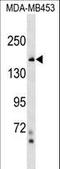 Tonsoku Like, DNA Repair Protein antibody, LS-C158382, Lifespan Biosciences, Western Blot image 