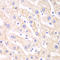 Proteasome Inhibitor Subunit 1 antibody, LS-C334133, Lifespan Biosciences, Immunohistochemistry paraffin image 