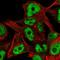 Zinc Finger Protein 559 antibody, HPA065485, Atlas Antibodies, Immunofluorescence image 