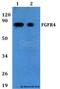 Fibroblast Growth Factor Receptor 4 antibody, A00769, Boster Biological Technology, Western Blot image 