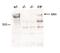 KMT2B antibody, CI1101, Boster Biological Technology, Western Blot image 