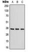 Adenosine receptor A1 antibody, LS-C353881, Lifespan Biosciences, Western Blot image 