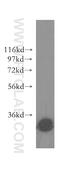 Galactosylceramidase antibody, 51051-2-AP, Proteintech Group, Western Blot image 