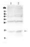 Hemoglobin Subunit Alpha 2 antibody, PA5-79347, Invitrogen Antibodies, Western Blot image 