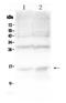 Hemoglobin Subunit Alpha 2 antibody, PA5-79347, Invitrogen Antibodies, Western Blot image 