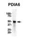 Protein Disulfide Isomerase Family A Member 6 antibody, NBP1-57999, Novus Biologicals, Western Blot image 