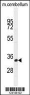 Store-Operated Calcium Entry Associated Regulatory Factor antibody, 55-387, ProSci, Western Blot image 