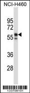 Keratin 6B antibody, 57-231, ProSci, Western Blot image 