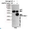 Protein Kinase AMP-Activated Non-Catalytic Subunit Beta 1 antibody, LS-C814091, Lifespan Biosciences, Immunoprecipitation image 