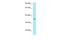 Hydroxypyruvate Isomerase (Putative) antibody, A14191, Boster Biological Technology, Western Blot image 