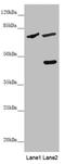 Solute Carrier Family 39 Member 4 antibody, LS-C682139, Lifespan Biosciences, Western Blot image 