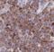 STT3 Oligosaccharyltransferase Complex Catalytic Subunit B antibody, FNab08356, FineTest, Immunohistochemistry paraffin image 