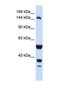 ABI Family Member 3 Binding Protein antibody, NBP1-69394, Novus Biologicals, Western Blot image 
