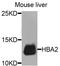 Hemoglobin Subunit Alpha 2 antibody, A8427, ABclonal Technology, Western Blot image 