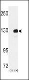UPF1 RNA Helicase And ATPase antibody, 60-295, ProSci, Western Blot image 